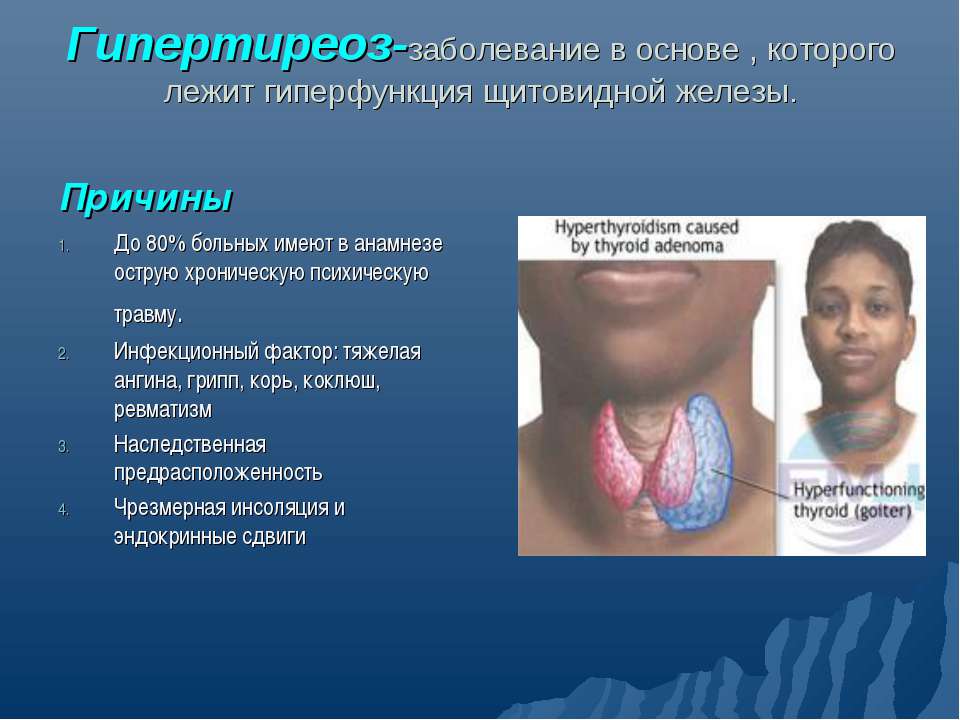 Гипертиреоз - Скачать презентации бесплатно | Читать или скачать учебники для школы онлайн бесплатно ☑ Школьные учебники school-textbook.com