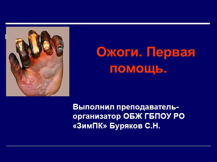Презентация на тему "Первая помощь при ожогах". - Скачать презентации бесплатно | Читать или скачать учебники для школы онлайн бесплатно ☑ Школьные учебники school-textbook.com