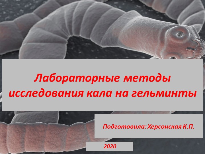 Лабораторные методы исследования гельминтов в кале - Скачать презентации бесплатно | Читать или скачать учебники для школы онлайн бесплатно ☑ Школьные учебники school-textbook.com