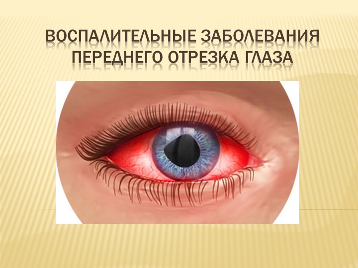 Презентация на тему "Воспалительные заболевания переднего отрезка глаза" - Скачать презентации бесплатно | Читать или скачать учебники для школы онлайн бесплатно ☑ Школьные учебники school-textbook.com