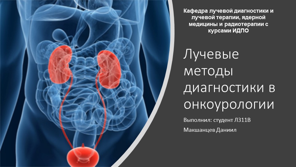 Презентация на тему: "Лучевая диагностика в онкоурологии" - Скачать презентации бесплатно | Читать или скачать учебники для школы онлайн бесплатно ☑ Школьные учебники school-textbook.com